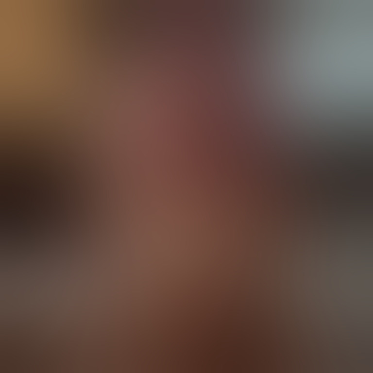 img blurred in free version